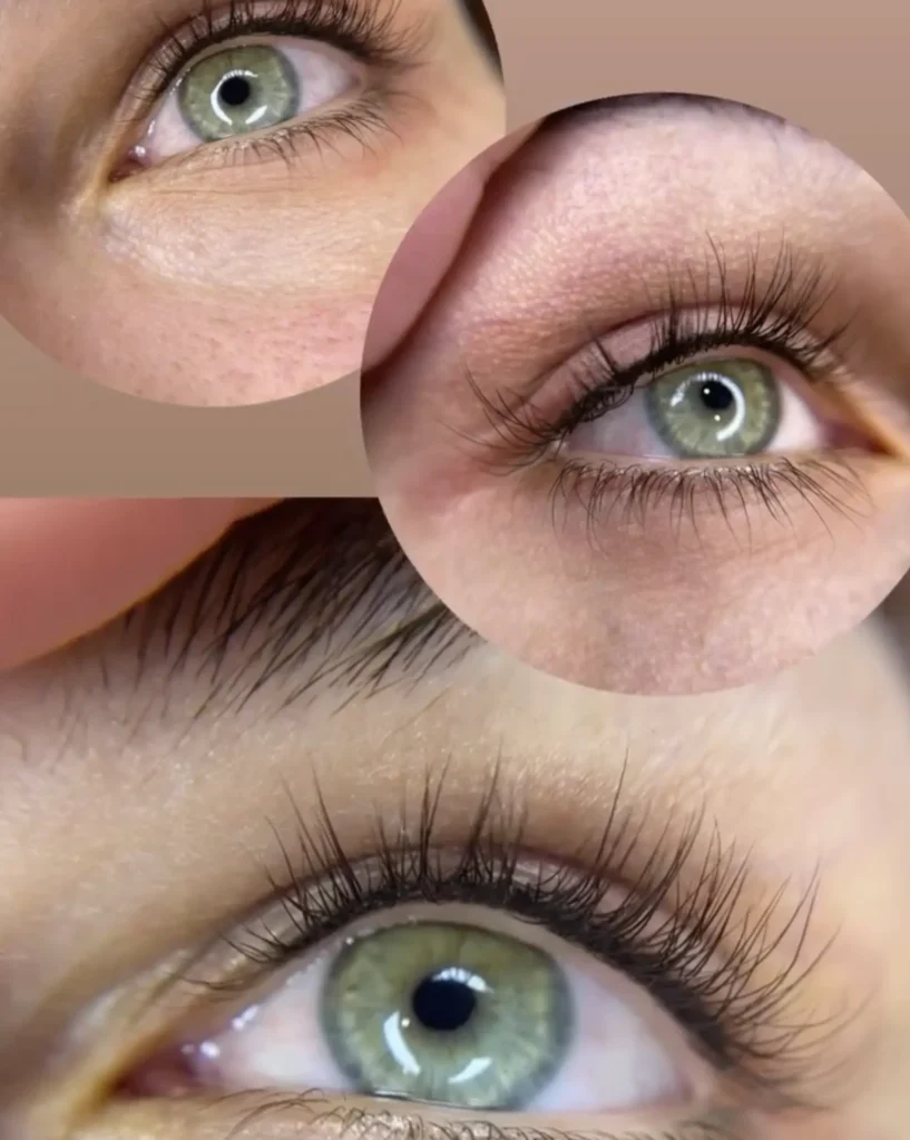 cosmetic eyeliner tattooing